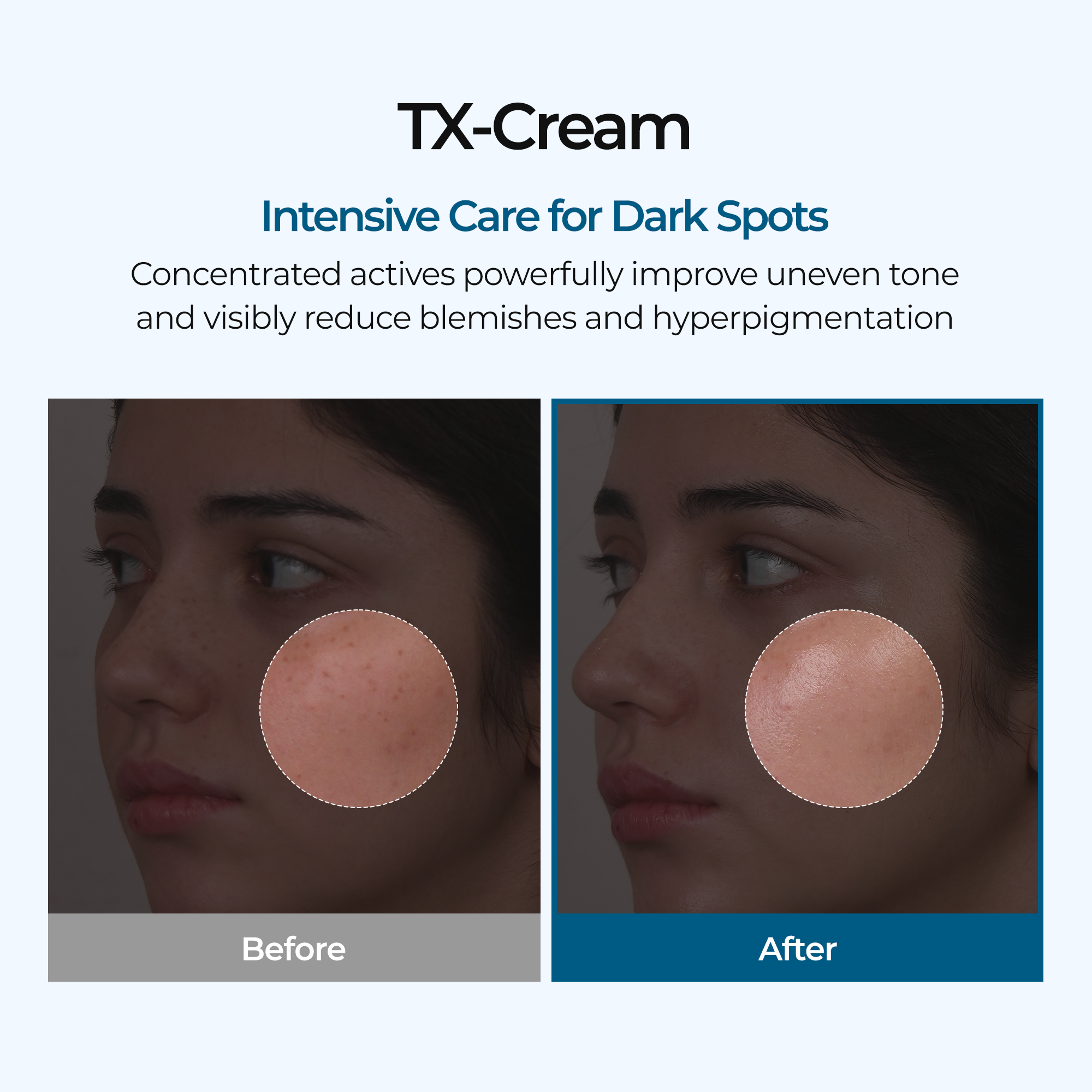 TX Cream - image 3